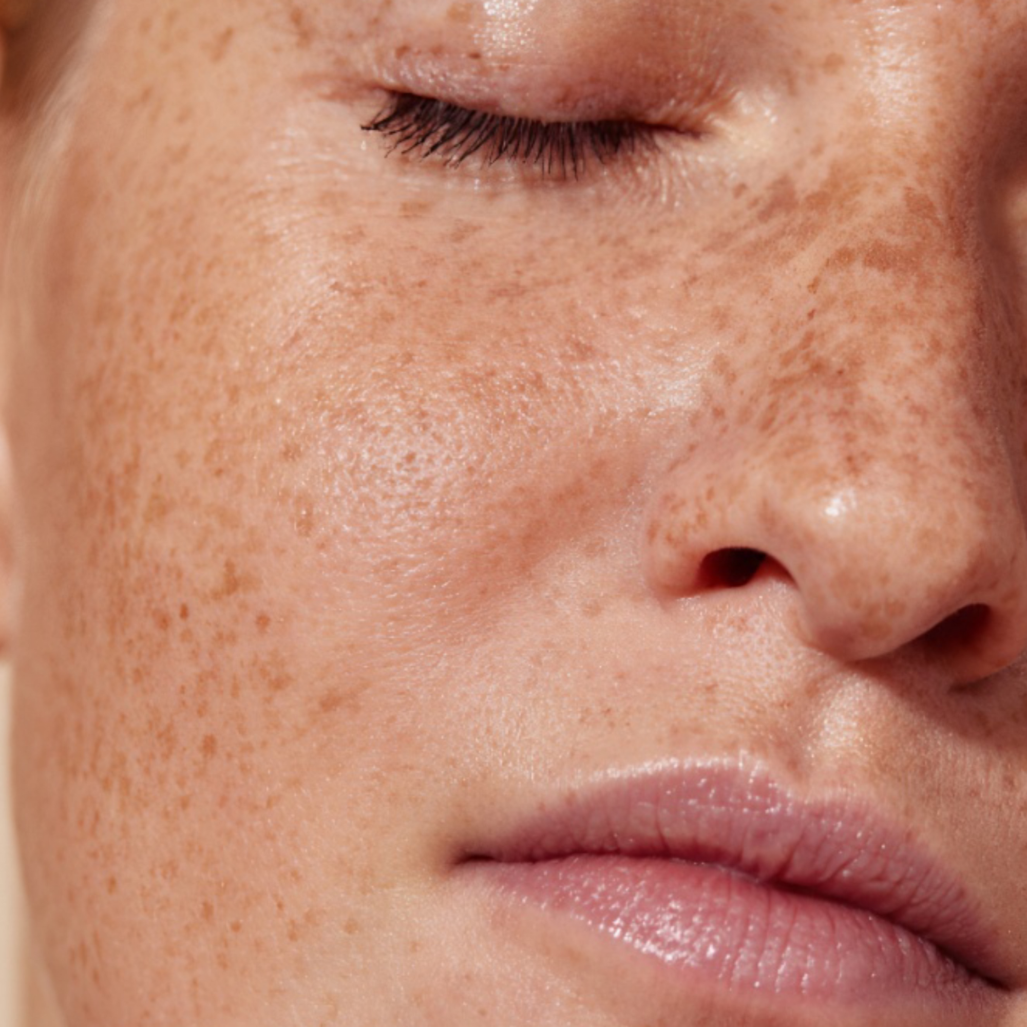 clean and clear skin acne 